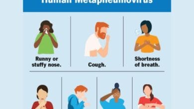 Human Metapneumovirus (HMPV) | Symptoms and conditions 21 Human Metapneumovirus (HMPV) | Symptoms and conditions