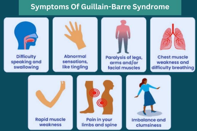 Prevalence of Guillain-Barre Syndrome (GBS). Symptoms and treatment