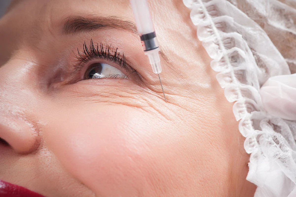 A woman gets a filler in her face